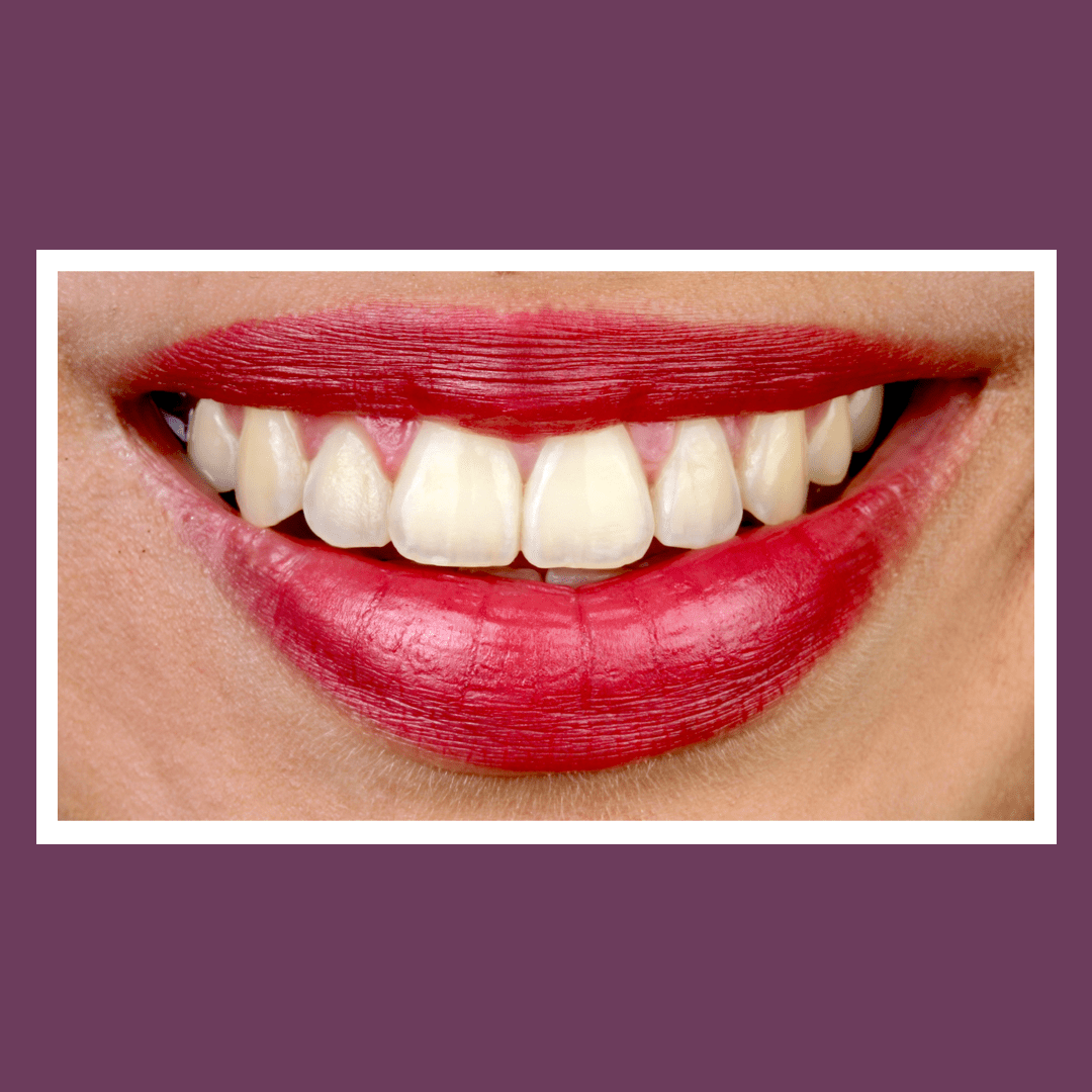 01-leende-periodonciaa